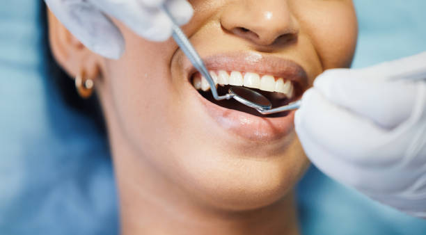 Best Chipped Tooth Repair Near Me  in Grand Point, LA