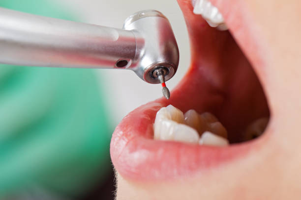 Best Broken Tooth Emergency  in Grand Point, LA